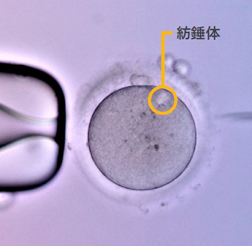 紡錘体(偏光観察)