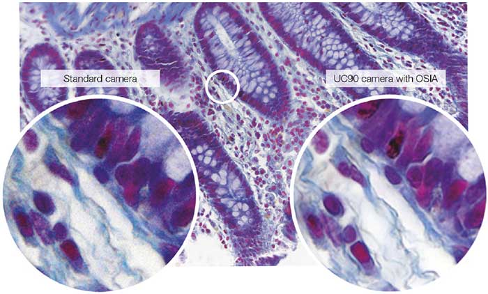 Figure 1: Seeing the Details, Not the Noise