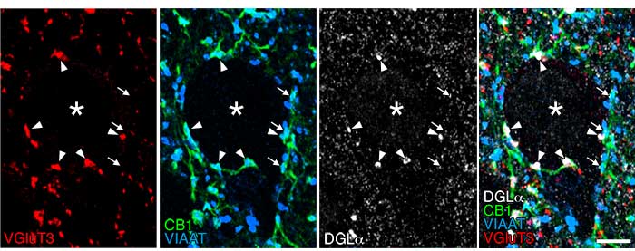 Quadruple immunofluorescence of brain tissue: Picture (1)