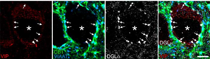 uadruple immunofluorescence of brain tissue: Picture (2)