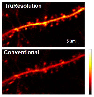 Figure 4: In vivo observation of neuronal dendrite in a live mouse brain (Thy1-YFP-H mouse, sensory cortex) acquired at 400 µm depth, with excitation at 960 nm.