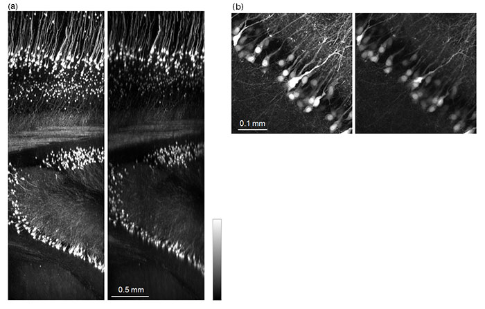 Figure 5: Mouse brain (Thy1-YFP-H mouse）cleared with ScaleA2.