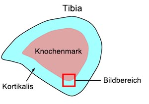 Abb. 1: Tibia-Querschnitt