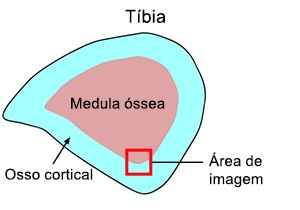 Figura 1: Seção tibial