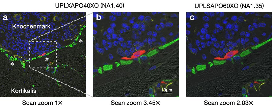 Abb. 2: Fluoreszenzbilder eines Querschnitts der Tibia einer Maus