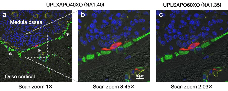 Figura 2: Imagens fluorescentes de uma seção tibial de rato