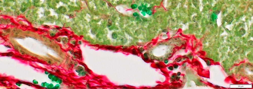 小鼠肝脏组织。厚度：4微米，染色：Picro-Sirius-Red和Fast-Green（实验室：Medizinische Universität Wien, Innere Medizin III, HEPEX Labor für Portale Hypertension und Fibrose bei Lebererkrankungen，奥地利）