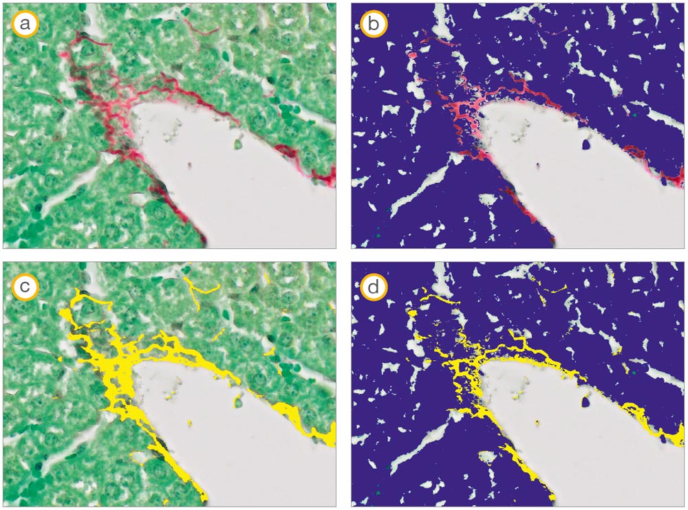 小鼠肝脏组织：（a）源图像，（b）绿色染色组织的手动阈值设置（蓝色），（c）红色染色纤维的手动阈值设置（黄色），（d）两个阶段的综合阈值