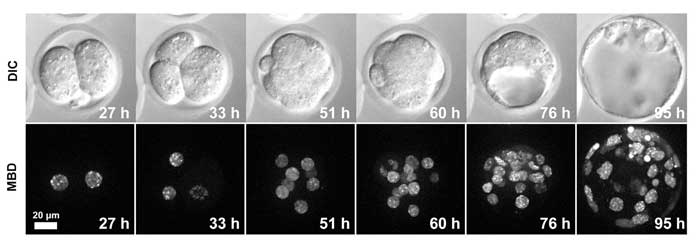 图2.植入前MethylRO胚胎发育过程中的活细胞成像。 在大约4天内观察到细胞核中甲基化DNA（mCherry-MBD-NLS）的变化。