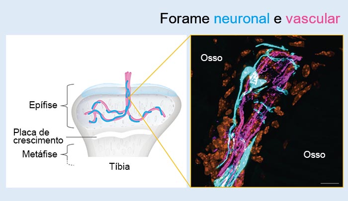 Figura 2: Forame neuronal e vascular
