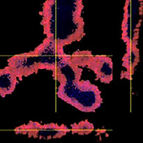 Antibody drug   volume recognition