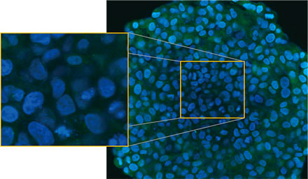 图2 A和2 B：表达EGFP-LC3的HeLa细胞微球（A）处于正常状态，（B）使用CQ处理。放大图像显示为原始微球图像的黄色矩形区域。