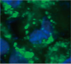 图2 C 左 ：使用CQ的微球内细胞的原始图像