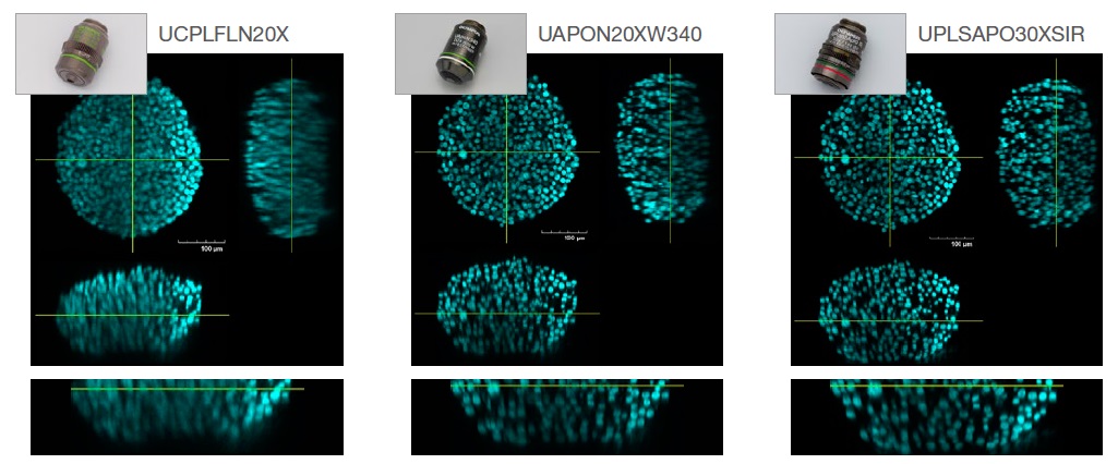 图2.物镜选择对图像分辨率的影响。左：干式（RI：1.00, UCPLFLN20X)。中：水浸（RI：1.33, UAPON20XW340)。