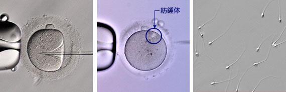 ICSI(レリーフコントラスト観察) 、紡錘体（偏光観察）、精子（DIC）