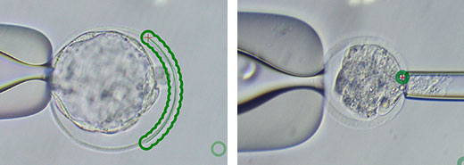 Laser Manipulation of Embryos