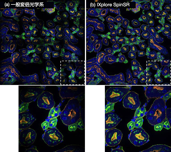 図９．IXplore SpinSR専用の変倍光学系で接続したシステム(b)と一般的な変倍光学系で接続したシステム(a)で取得した蛍光画像16枚（縦4枚x横4枚）を貼り合わせた画像。