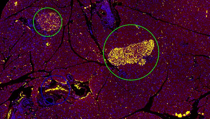 10倍图像为基于常规阈值方法的检测结果（绿色），该方法无法区分胰岛与血红细胞（蓝色）。