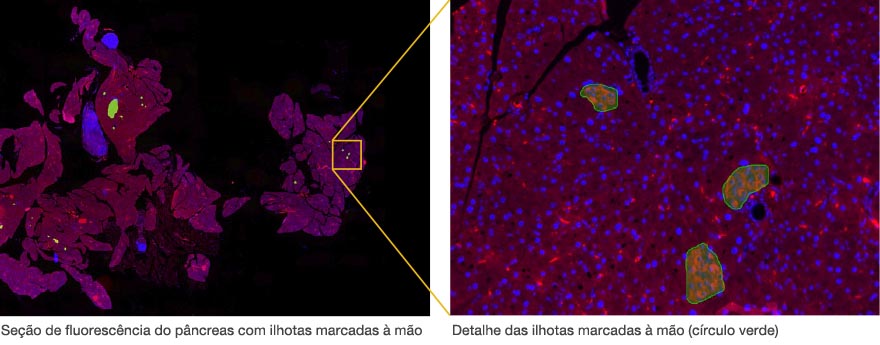 Seção de fluorescência do pâncreas com ilhotas marcadas à mão / Detalhe das ilhotas marcadas à mão (círculo verde)