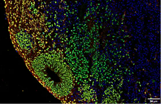 Organoids
