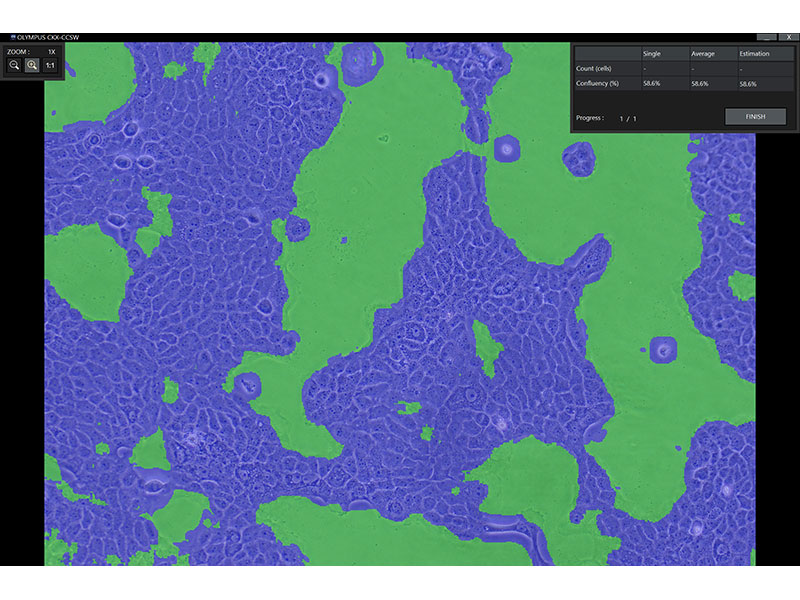 Cell density