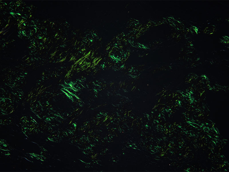 ハイコントラストスタイル (コンゴーレッド/偏光観察)