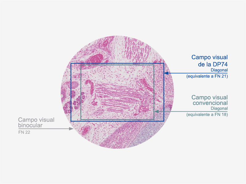 Uno de los campos visuales más amplios del mercado