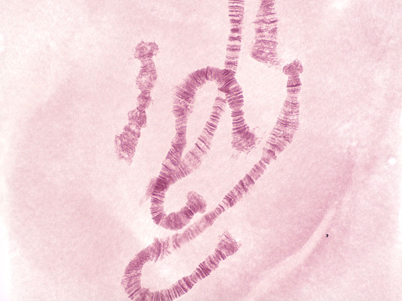 样本：多线染色体 显微镜：CX23，物镜：平场消色差物镜40x (NA 0.65)，TV适配器：U-TV0.5XC-3，照明：明场（LED），曝光时间：16.9毫秒