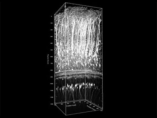 Image data courtesy of Katsuya Ozawa and Hajime Hirase, Neuron–Glia Circuitry, RIKEN Brain Science Institute, Japan