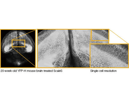 Image data courtesy of Hiroshi Hama, Atsushi Miyawaki, RIKEN Brain Science Institute Laboratory for Cell Function Dynamics