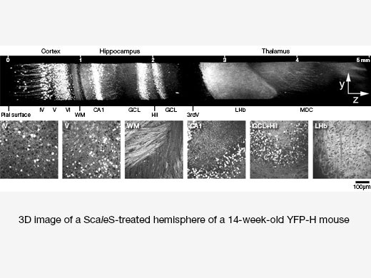 Image data courtesy of Hiroshi Hama, Atsushi Miyawaki, RIKEN Brain Science Institute Laboratory for Cell Function Dynamics Reference: Nat Neurosci. 2015 Oct; 18 (10): 1518–29. doi: 10.1038/nn.4107. Epub 2015 Sep 14.