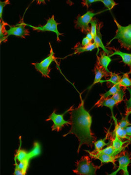 Fluorescence Imaging