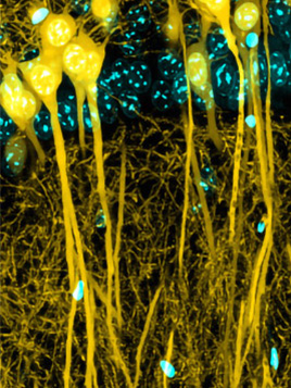 Laser Scanning Confocal