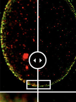 Super Resolution and TIRF Imaging