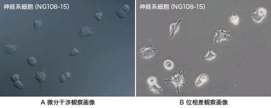 図1 微分干渉観察と位相差観察の比較