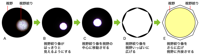 視野絞り調整の流れ