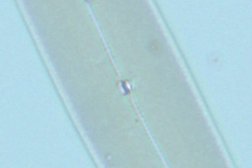 図5 分解能が不十分