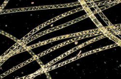 図11 暗視野観察による無染色の藻（アオミドロ）