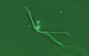 図14 ネガティブコントラスト（アスベスト）