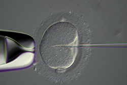 図18 レリーフコントラスト観察による人工授精