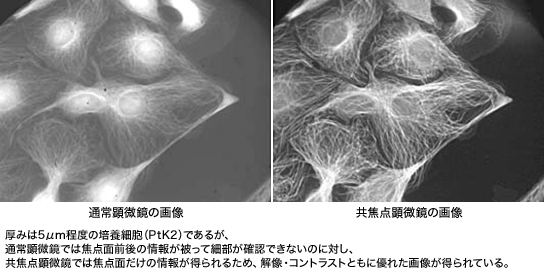 図3 通常顕微鏡と蛍光共焦点顕微鏡の画像比較 図3 通常顕微鏡と蛍光共焦点顕微鏡の画像比較