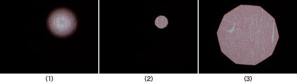 図2 視野絞りの調整方法