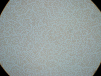 光線のけられ　画像