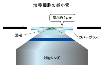培養細胞の微小管（カバーガラスに密着したPtk2［表面から約1μm］）