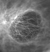 図4 油浸対物レンズ NA 1.42