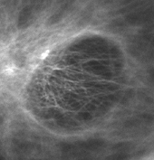 図5 水浸対物レンズ NA 1.2