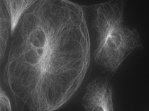 図8 油浸対物レンズ NA 1.42