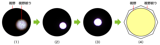 コンデンサの光軸調整