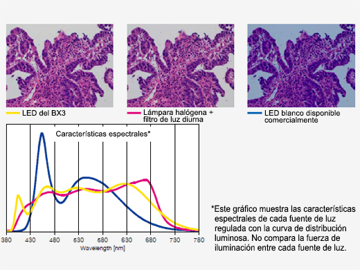 Luz LED de gran claridad optimizada para exámenes patológicos y citológicos