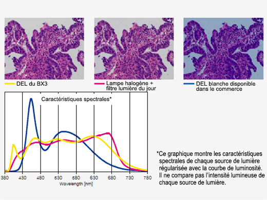 Éclairage à DEL lumineux optimisé pour la pathologie et la cytologie